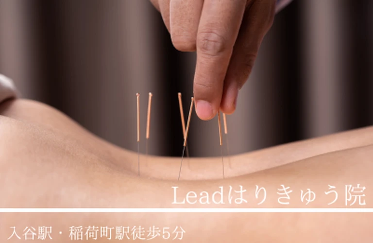 慢性痛を和らげる、上野の鍼灸で心と体の調和を取り戻す。